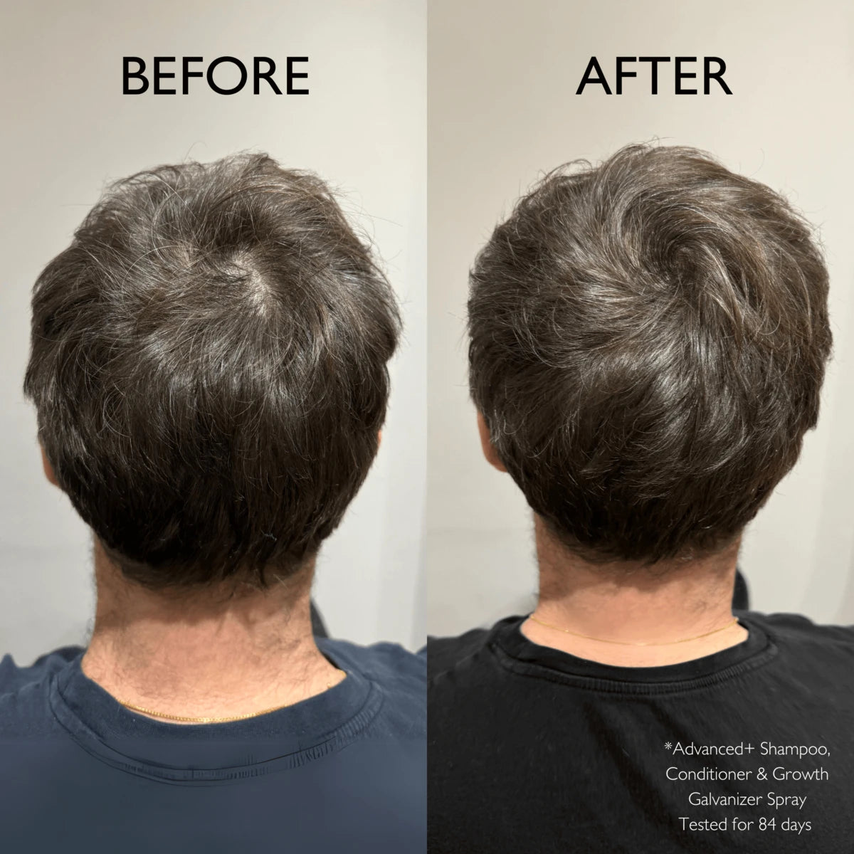 Advanced+ Haarwuchs-Galvanisator, 100 ml.