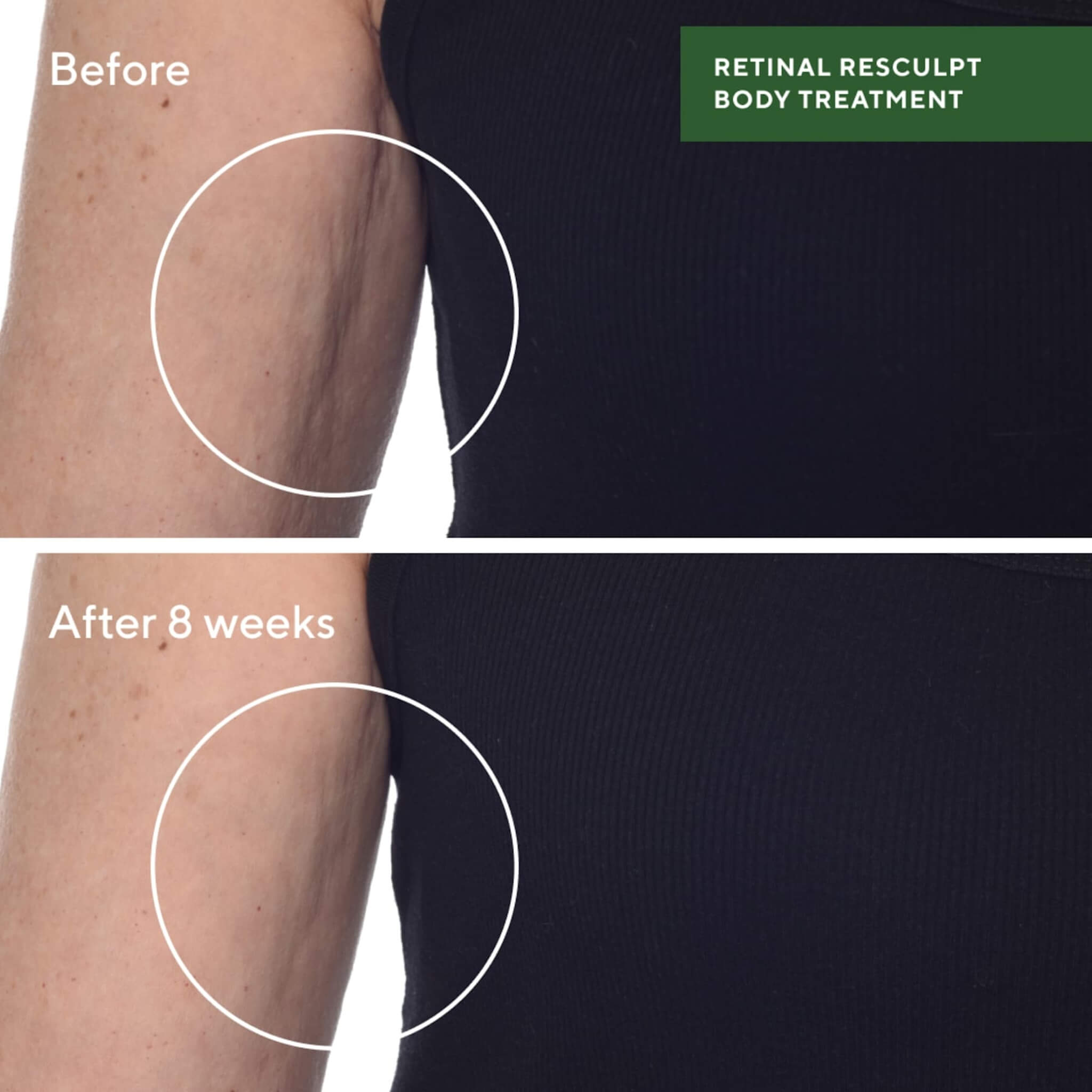 Retinal ReSculpt Körperbehandlung, Resurgence, 148 ml.