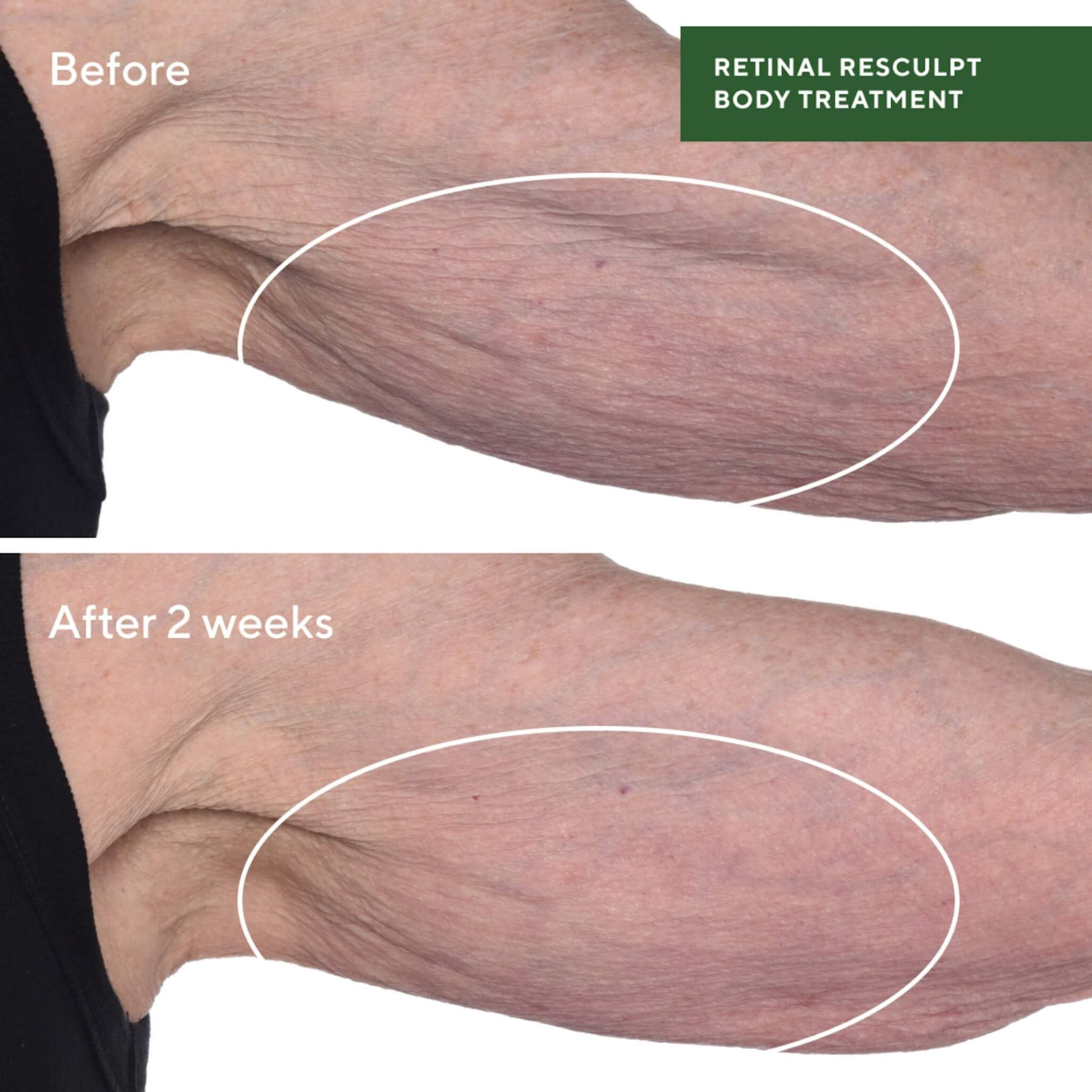 Retinal ReSculpt Körperbehandlung, Resurgence, 148 ml.