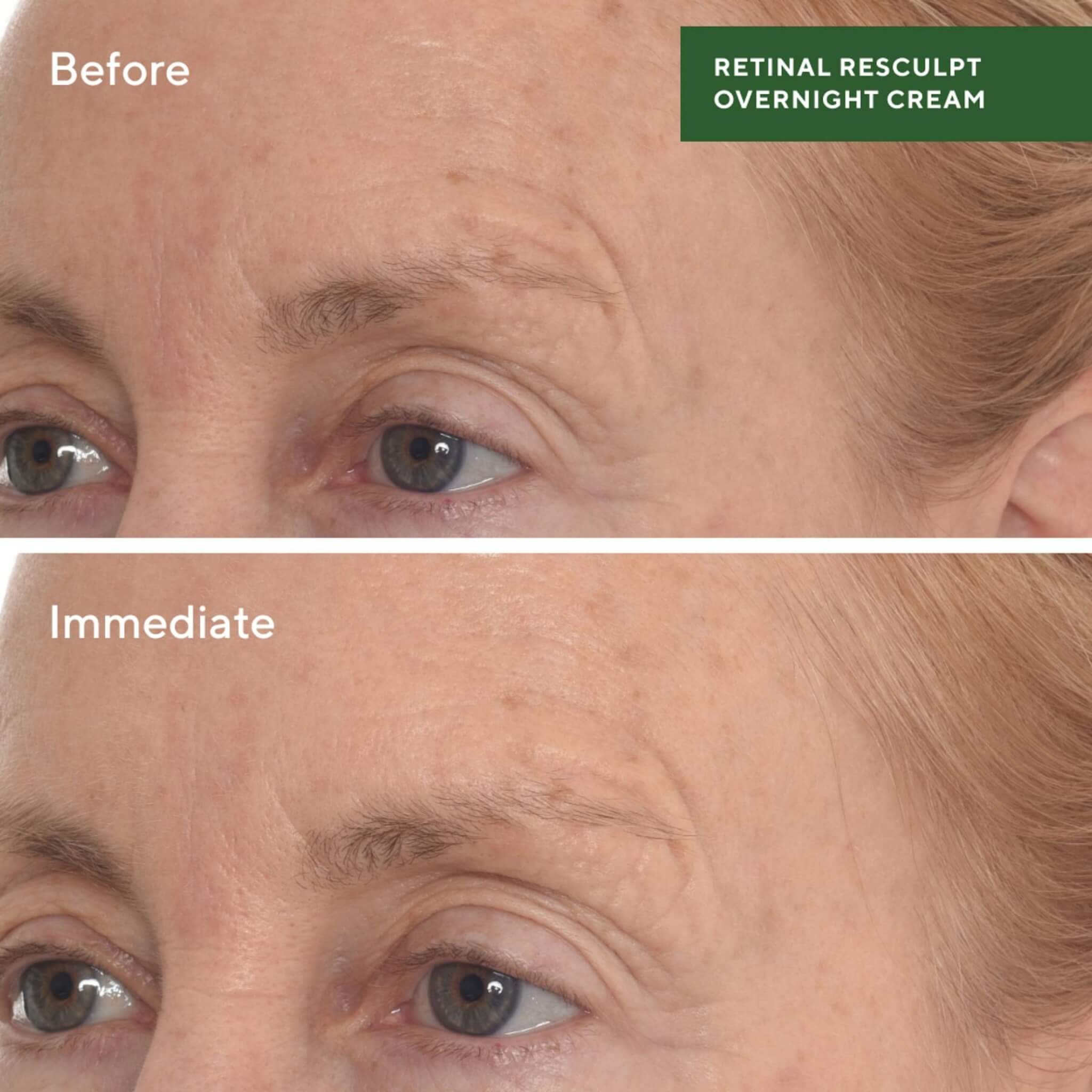 Retinal ReSculpt Über-Nacht-Creme, Resurgence, 50 ml.